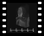 Video 1: Animation sequence comparing DVR, MIDA, and MIP applied to a MRI scan